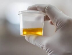 Kuasa Hukum : Pelaku KDRT Pegawai BNN, Perlu Ditest Urine dan Ditahan
