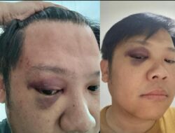 Korban Babak Belur, Oknum DPRD Diduga Terlibat Pengeroyokan